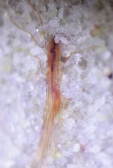 Spaghetti worm?
